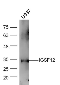 IGSF12 Rabbit Polyclonal Antibody