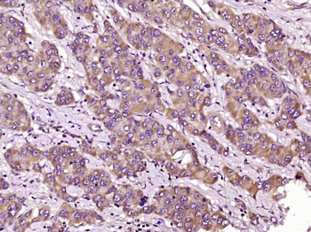TRIM7 Rabbit Polyclonal Antibody