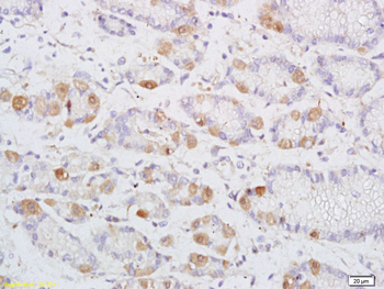 DENND2D Rabbit Polyclonal Antibody