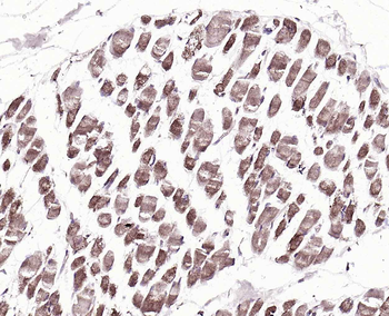 ECRG4 Rabbit Polyclonal Antibody