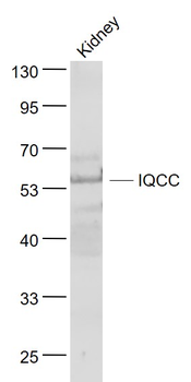 IQCC Rabbit Polyclonal Antibody