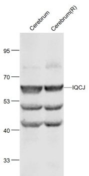 IQCJ antibody