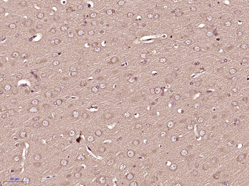 TRPM3 Rabbit Polyclonal Antibody