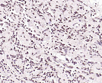 C8orf70 Rabbit Polyclonal Antibody