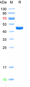 Recombinant human IKBKB protein