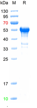 Recombinant human CYP8B1 protein