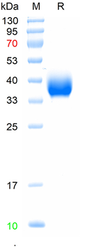 Recombinant SARS-Cov-2 Spike protein RBD (BA.2.86), (HEK293)