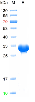 Recombinant human TRIM21 protein, N-His