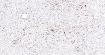 Human HLA-DR Ready-To-Use IHC Kit