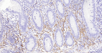 Human Tau-4 Ready-To-Use IHC Kit