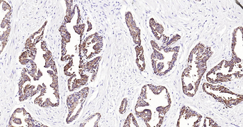 Human pan CK Ready-To-Use IHC Kit