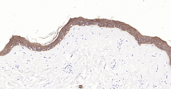 pan CK Ready-To-Use IHC Kit
