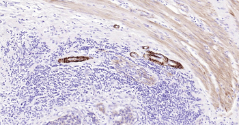 Human SMMHC Ready-To-Use IHC Kit