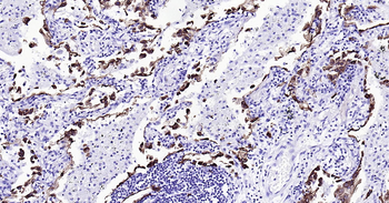 Human CK7 Ready-To-Use IHC Kit