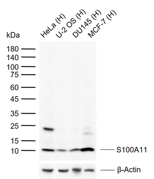 S100A11 Rabbit Polyclonal Antibody