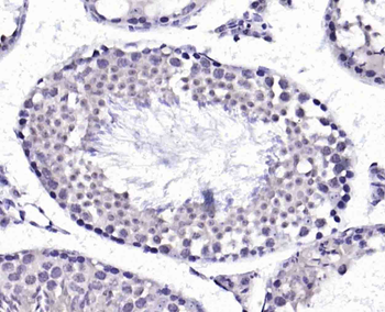 GSK3B Rabbit Polyclonal Antibody