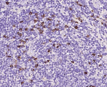 CD28 Rabbit Polyclonal Antibody