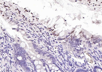 SOCS1 Mouse Monoclonal Antibody