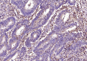 HLA E Rabbit Polyclonal Antibody