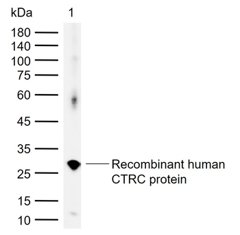 CTRC Rabbit Polyclonal Antibody