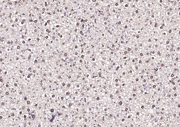 PHF2 Rabbit Polyclonal Antibody