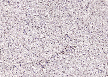 PHF2 Rabbit Polyclonal Antibody