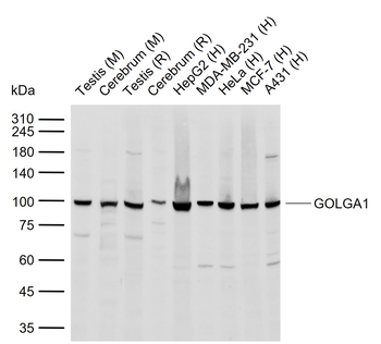 GOLGA1 Rabbit Polyclonal Antibody