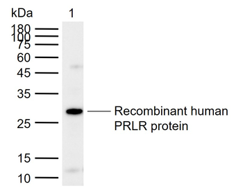 PRLR Rabbit Polyclonal Antibody