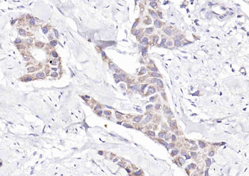 Raptor Rabbit Polyclonal Antibody