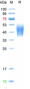 Recombinant human IL-4R-Alpha protein, C-His (HEK293)