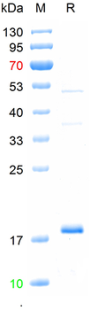 Recombinant human MASP2 protein, N-His