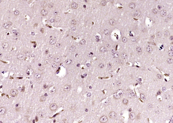 MMS19 Rabbit Polyclonal Antibody