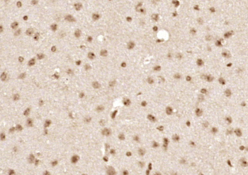 ASH1L Rabbit Polyclonal Antibody