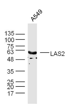 LAS2 Rabbit Polyclonal Antibody