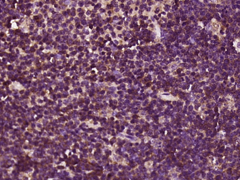 Phospho-BLNK (Tyr84) Rabbit Polyclonal Antibody