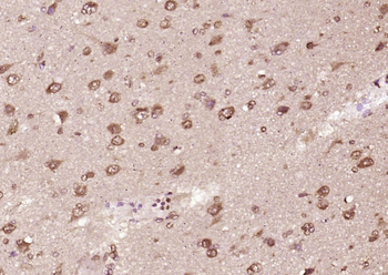 INTS3 Rabbit Polyclonal Antibody