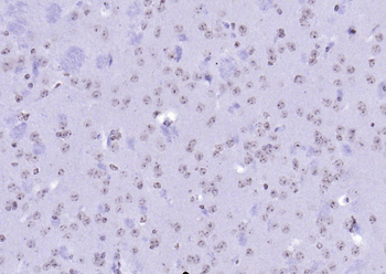 RNF113A Rabbit Polyclonal Antibody