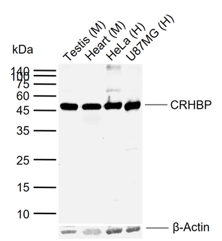 CRHBP Rabbit Polyclonal Antibody