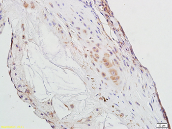 PPAR Gamma Rabbit Polyclonal Antibody