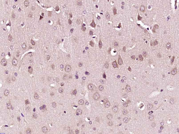 POMC Rabbit Polyclonal Antibody