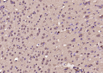 BTBD3 Rabbit Polyclonal Antibody