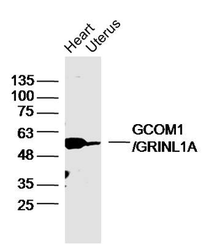 GCOM1/GRINL1A Rabbit Polyclonal Antibody