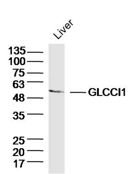 GLCCI1 Rabbit Polyclonal Antibody