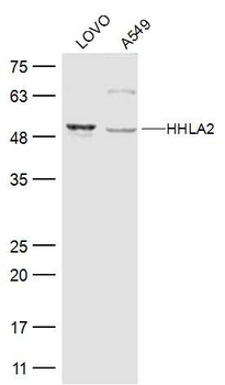 HHLA2 Rabbit Polyclonal Antibody