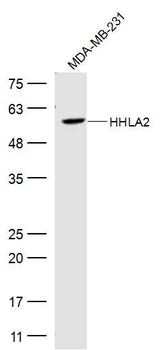 HHLA2 Rabbit Polyclonal Antibody