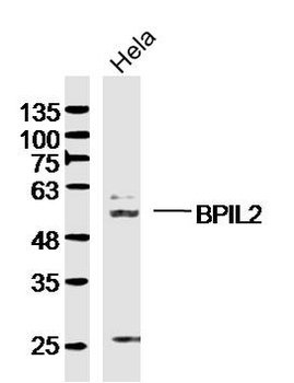 BPIL2 Rabbit Polyclonal Antibody