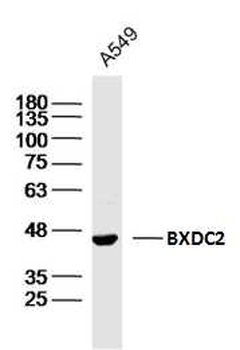 BXDC2 Rabbit Polyclonal Antibody