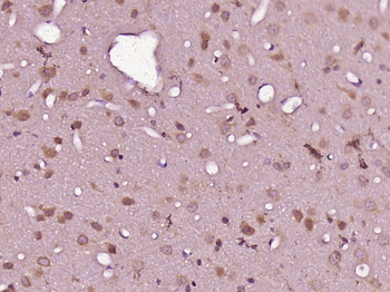 RNF157 Rabbit Polyclonal Antibody