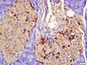 PRLR Rabbit Polyclonal Antibody