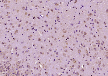 GNAS Rabbit Polyclonal Antibody